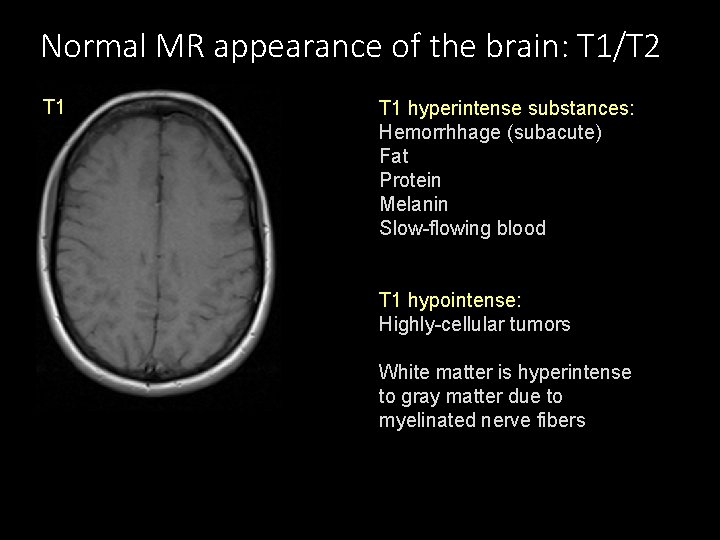 Normal MR appearance of the brain: T 1/T 2 T 1 hyperintense substances: Hemorrhhage