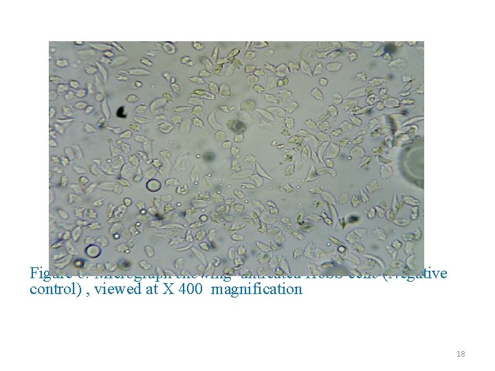 Figure 6: Micrograph showing untreated Hb. SS cells (Negative control) , viewed at X