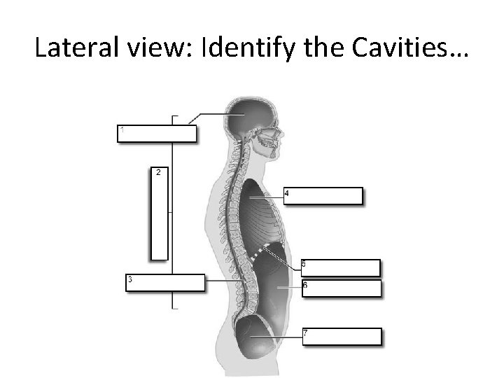 Lateral view: Identify the Cavities… 