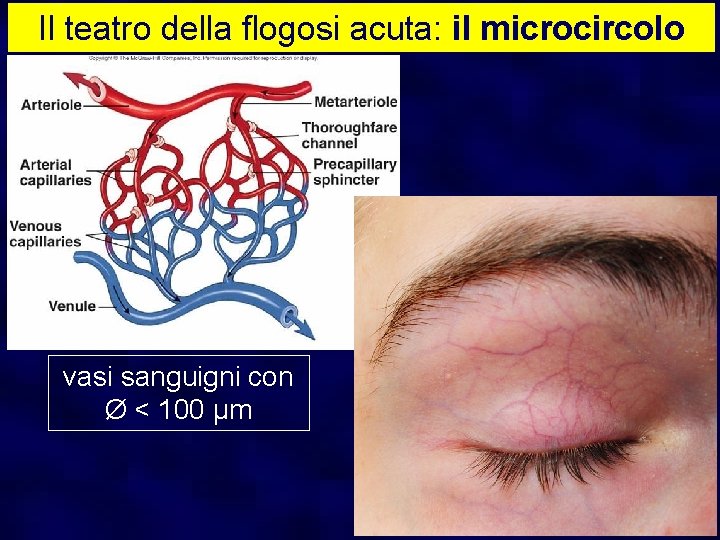 Il teatro della flogosi acuta: il microcircolo vasi sanguigni con Ø < 100 μm