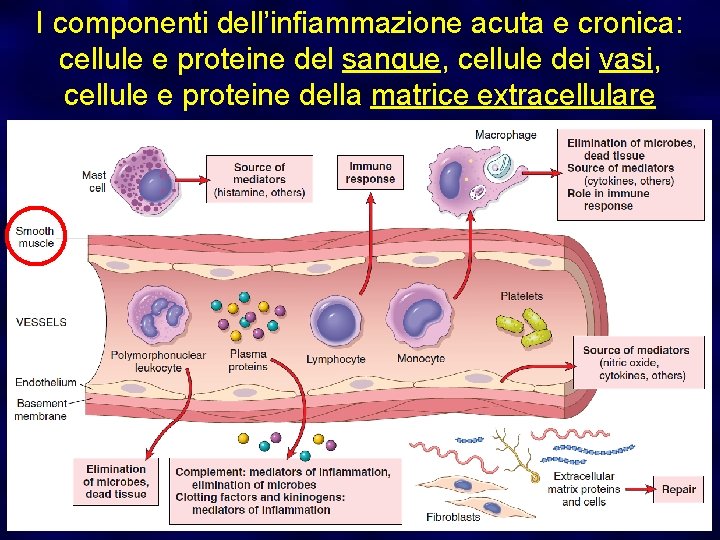 I componenti dell’infiammazione acuta e cronica: cellule e proteine del sangue, cellule dei vasi,