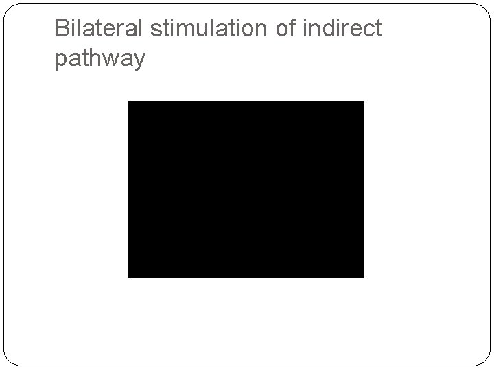 Bilateral stimulation of indirect pathway 