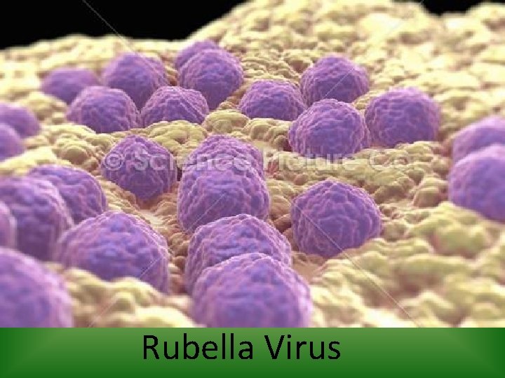 Rubella Virus 
