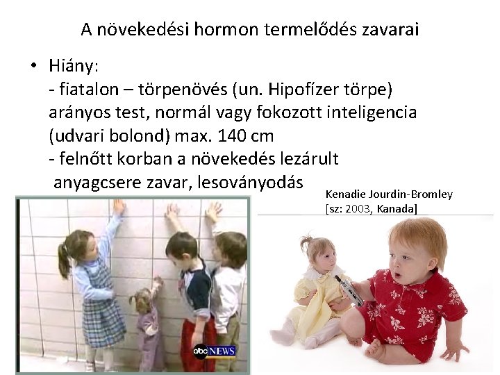 A növekedési hormon termelődés zavarai • Hiány: - fiatalon – törpenövés (un. Hipofízer törpe)