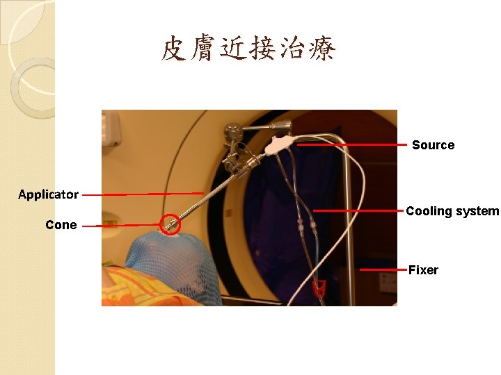 皮膚近接治療 Source Applicator Cooling system Cone Fixer 