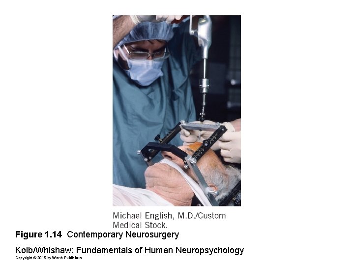 Figure 1. 14 Contemporary Neurosurgery Kolb/Whishaw: Fundamentals of Human Neuropsychology Copyright © 2015 by