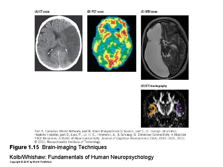 Figure 1. 15 Brain-imaging Techniques Kolb/Whishaw: Fundamentals of Human Neuropsychology Copyright © 2015 by