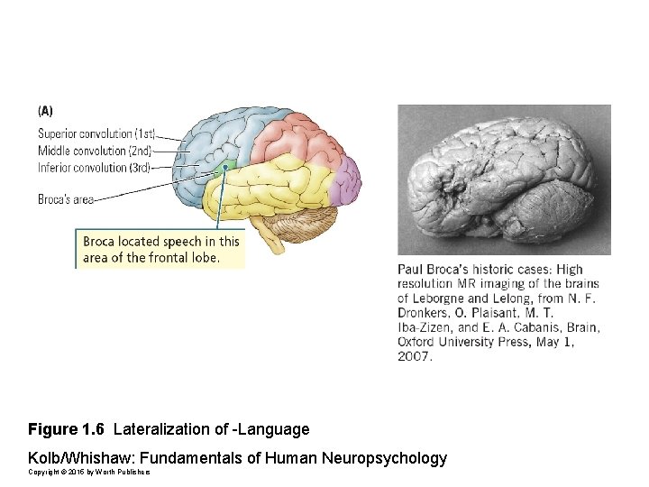 Figure 1. 6 Lateralization of -Language Kolb/Whishaw: Fundamentals of Human Neuropsychology Copyright © 2015