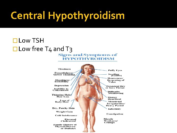 Central Hypothyroidism � Low TSH � Low free T 4 and T 3 