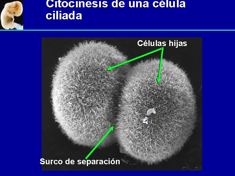 Citocinesis de una célula ciliada Células hijas Surco de separación 