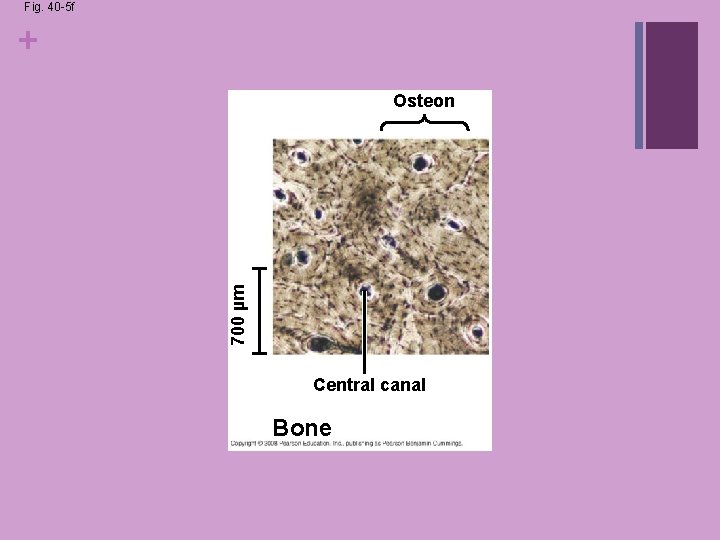 Fig. 40 -5 f + 700 µm Osteon Central canal Bone Fig. 40 -5 f + 700 µm Osteon Central canal Bone