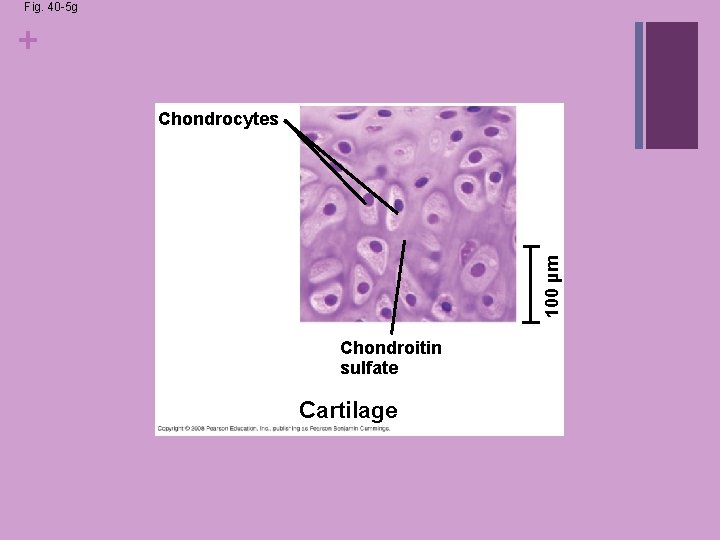 Fig. 40 -5 g + 100 µm Chondrocytes Chondroitin sulfate Cartilage Fig. 40 -5 g + 100 µm Chondrocytes Chondroitin sulfate Cartilage