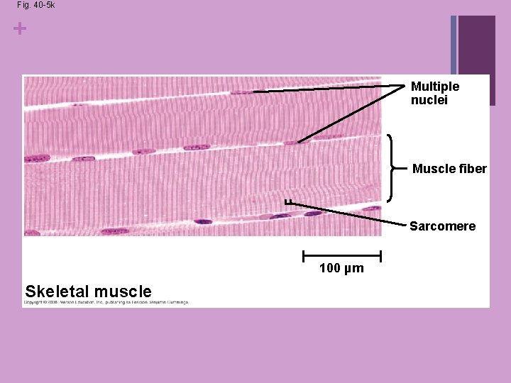 Fig. 40 -5 k + Multiple nuclei Muscle fiber Sarcomere 100 µm Skeletal muscle Fig. 40 -5 k + Multiple nuclei Muscle fiber Sarcomere 100 µm Skeletal muscle