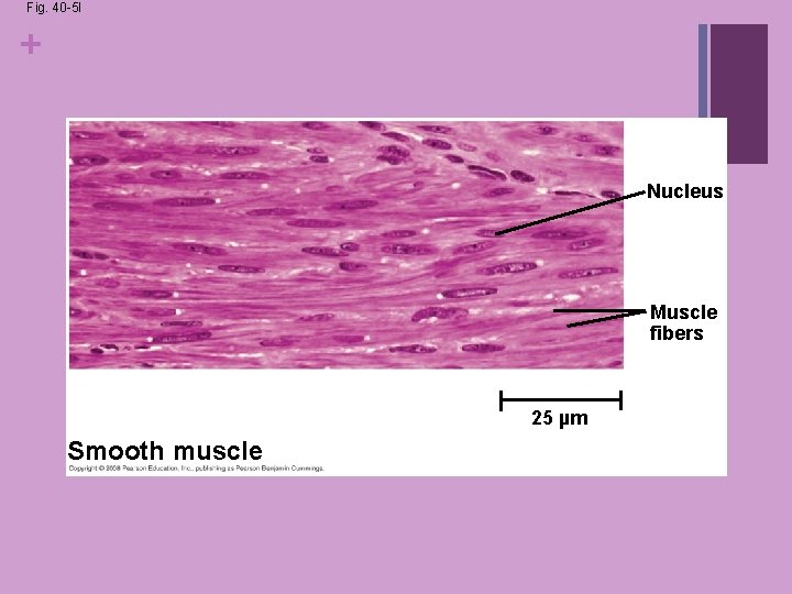 Fig. 40 -5 l + Nucleus Muscle fibers 25 µm Smooth muscle Fig. 40 -5 l + Nucleus Muscle fibers 25 µm Smooth muscle