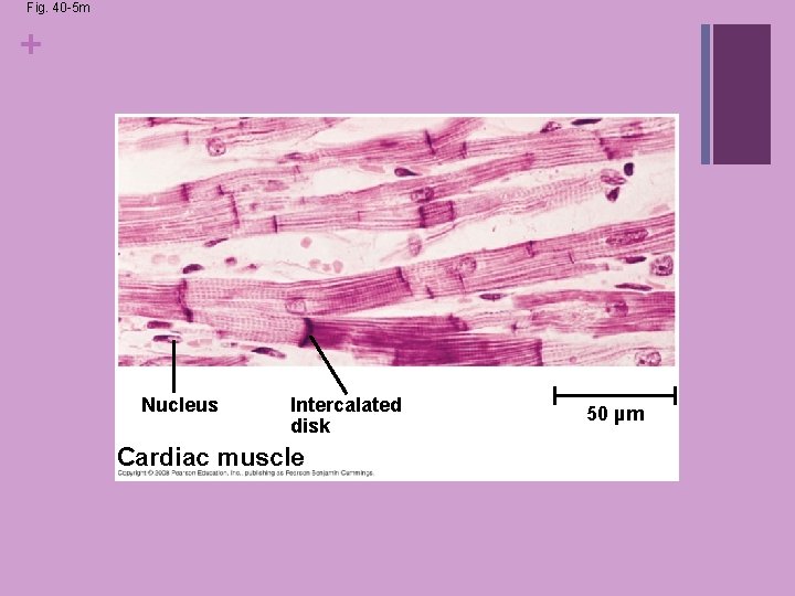 Fig. 40 -5 m + Nucleus Intercalated disk Cardiac muscle 50 µm Fig. 40 -5 m + Nucleus Intercalated disk Cardiac muscle 50 µm