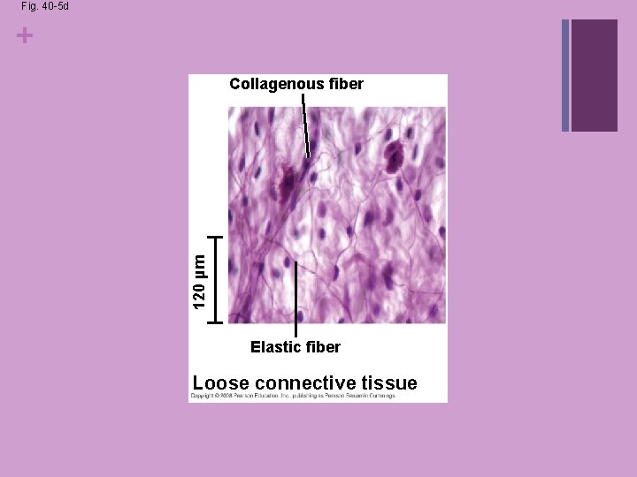 Fig. 40 -5 d + 120 µm Collagenous fiber Elastic fiber Loose connective tissue Fig. 40 -5 d + 120 µm Collagenous fiber Elastic fiber Loose connective tissue