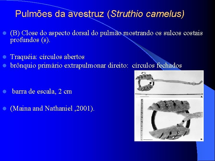 Pulmões da avestruz (Struthio camelus) l (B) Close do aspecto dorsal do pulmão mostrando