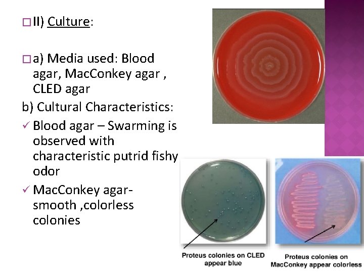 � II) � a) Culture: Media used: Blood agar, Mac. Conkey agar , CLED