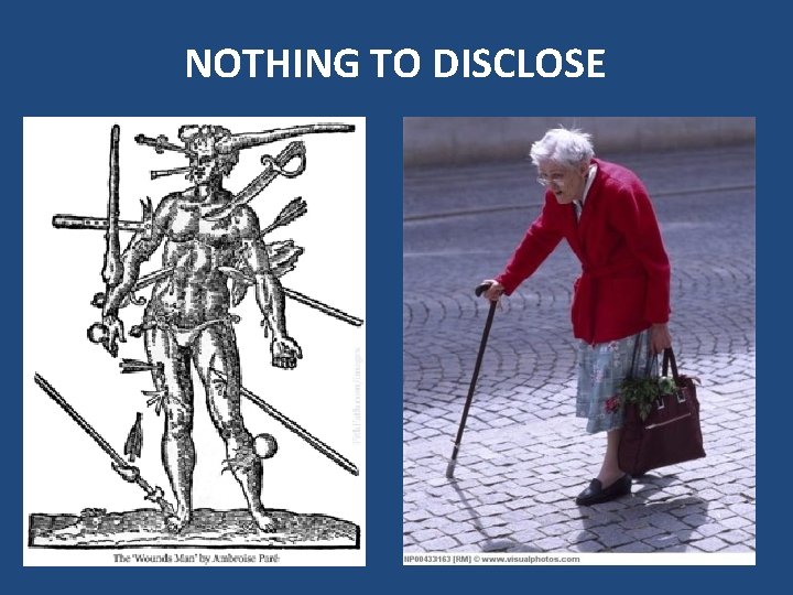 NOTHING TO DISCLOSE 