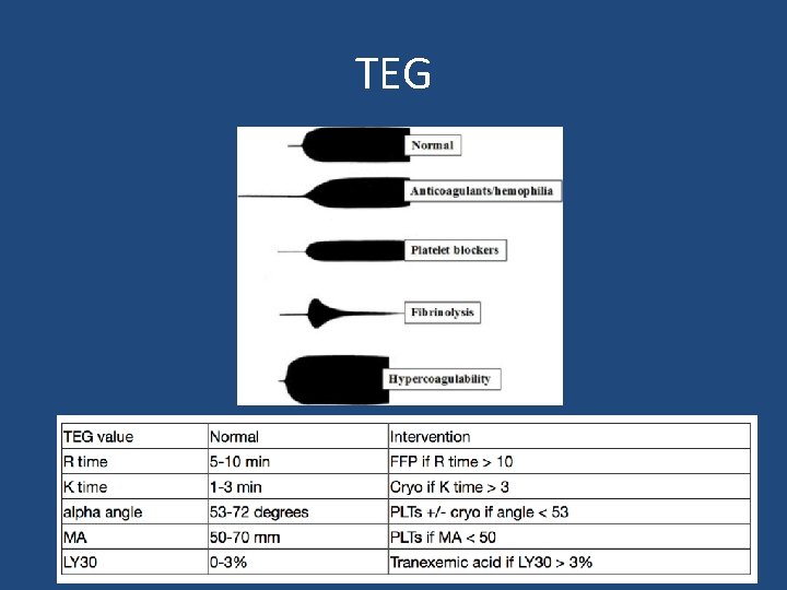 TEG 