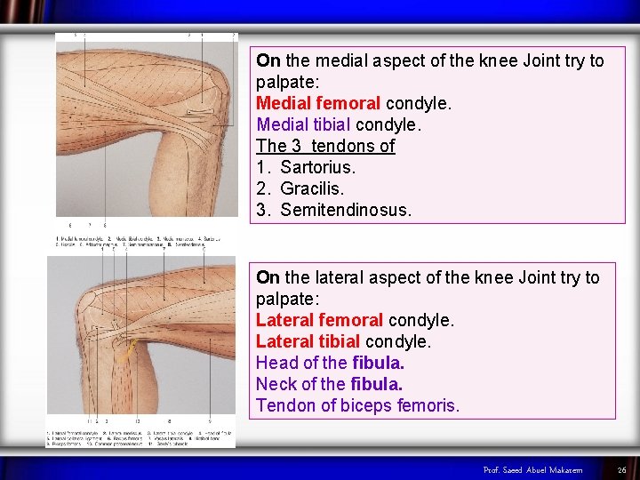 On the medial aspect of the knee Joint try to palpate: Medial femoral condyle.