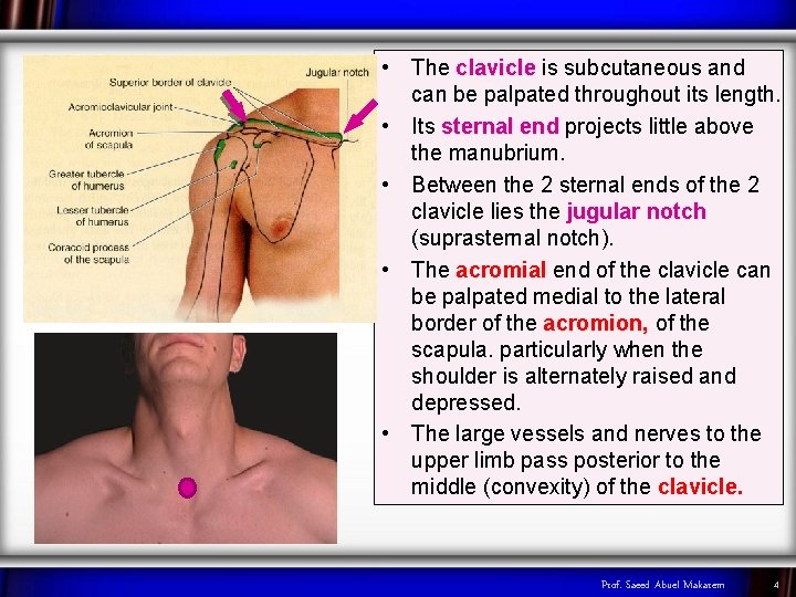  • The clavicle is subcutaneous and can be palpated throughout its length. •