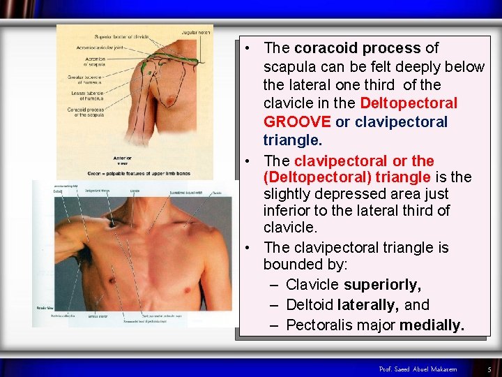 • The coracoid process of scapula can be felt deeply below the lateral