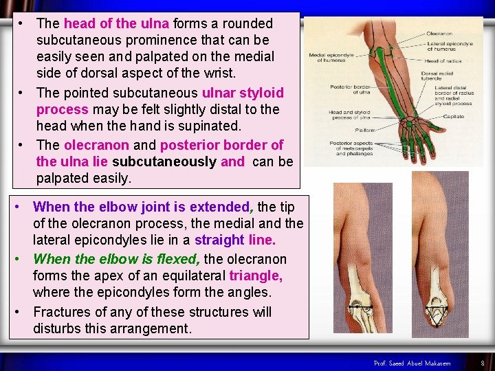  • The head of the ulna forms a rounded subcutaneous prominence that can