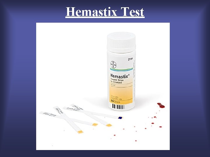 SEROLOGY SEROLOGY The science of body fluid identification