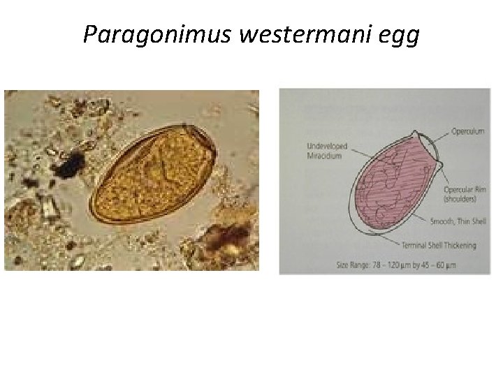 Paragonimus westermani egg 