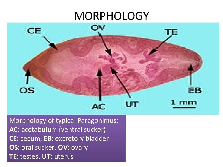 MORPHOLOGY Morphology of typical Paragonimus: AC: acetabulum (ventral sucker) CE: cecum, EB: excretory bladder