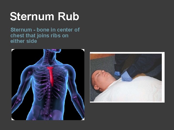 Sternum Rub Sternum - bone in center of chest that joins ribs on either