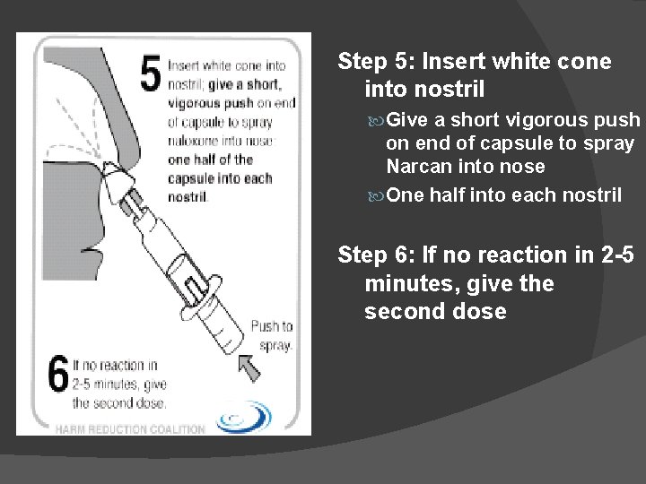 Step 5: Insert white cone into nostril Give a short vigorous push on end