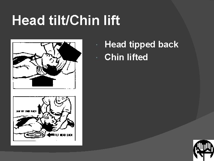 Head tilt/Chin lift Head tipped back Chin lifted 