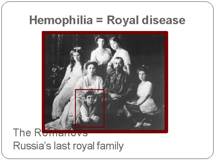 Hemophilia = Royal disease The Romanovs Russia’s last royal family 