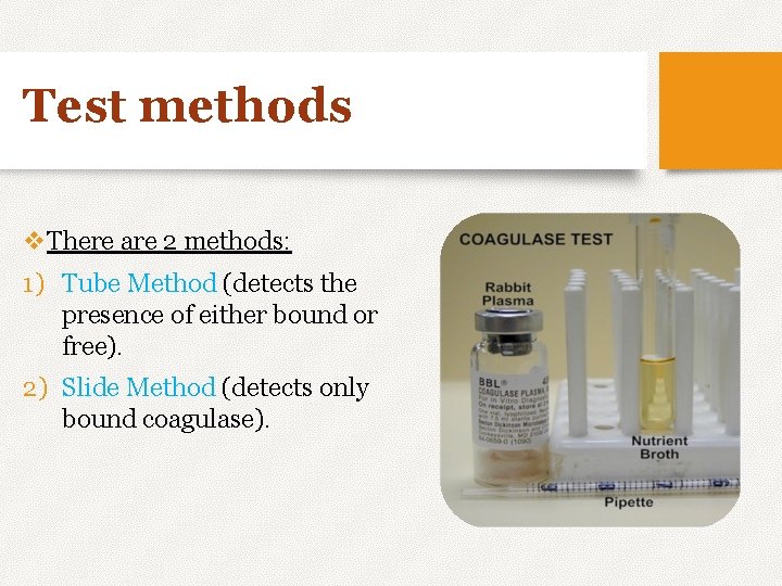 Test methods v. There are 2 methods: 1) Tube Method (detects the presence of