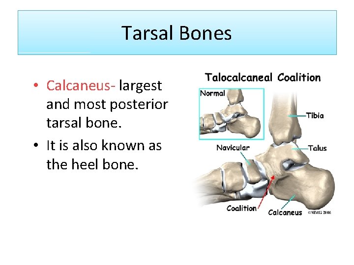 Tarsal Bones • Calcaneus- largest and most posterior tarsal bone. • It is also