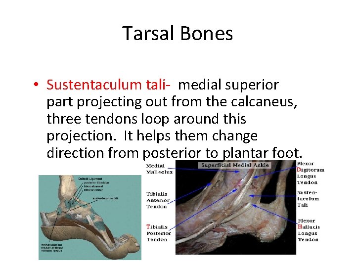 Tarsal Bones • Sustentaculum tali- medial superior part projecting out from the calcaneus, three