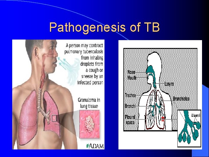 Pathogenesis of TB 