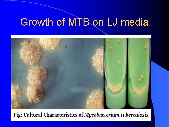 Growth of MTB on LJ media 
