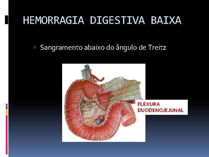 HEMORRAGIA DIGESTIVA BAIXA Sangramento abaixo do ângulo de Treitz FLEXURA DUODENOJEJUNAL 