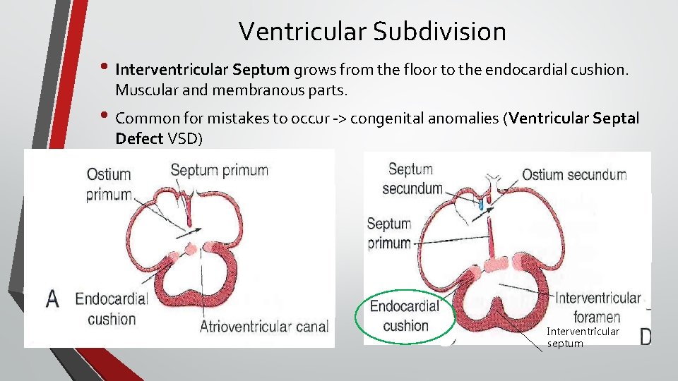 Ventricular Subdivision • Interventricular Septum grows from the floor to the endocardial cushion. Muscular