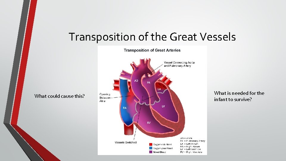 Transposition of the Great Vessels What could cause this? What is needed for the