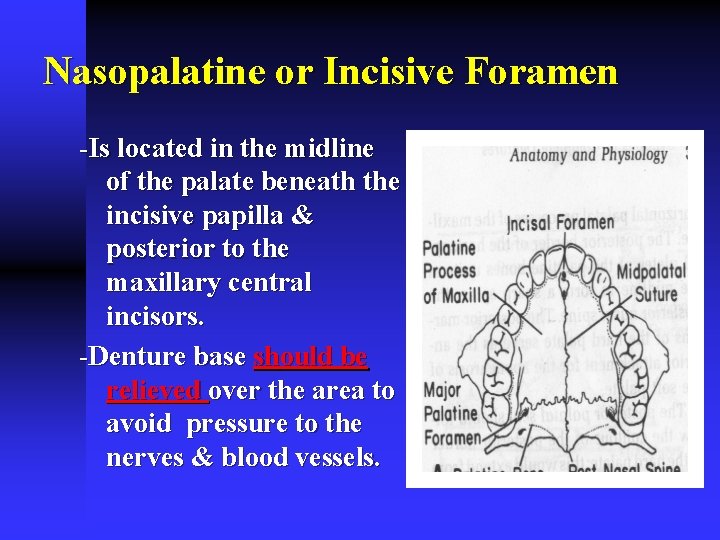 Nasopalatine or Incisive Foramen -Is located in the midline of the palate beneath the