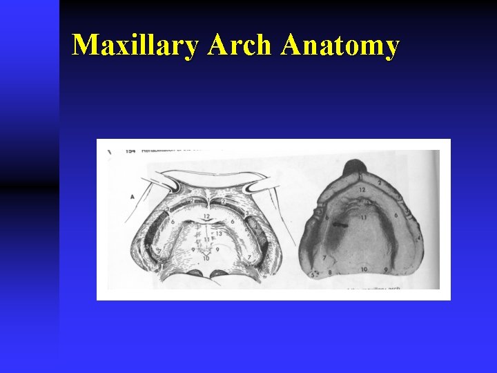 Maxillary Arch Anatomy 