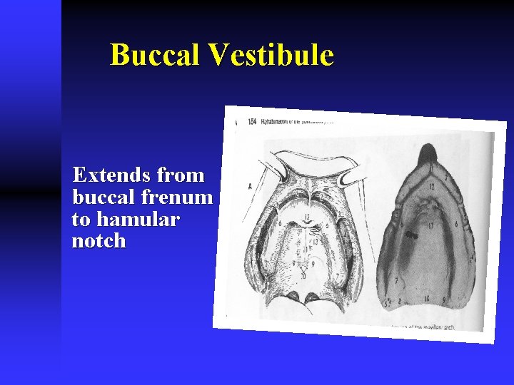 Buccal Vestibule Extends from buccal frenum to hamular notch 