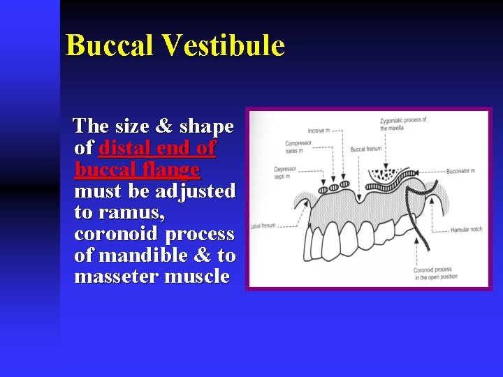 Buccal Vestibule The size & shape of distal end of buccal flange must be