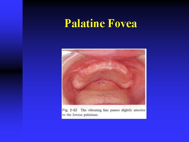 Palatine Fovea 