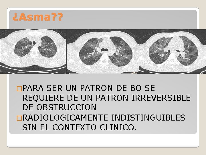¿Asma? ? �PARA SER UN PATRON DE BO SE REQUIERE DE UN PATRON IRREVERSIBLE
