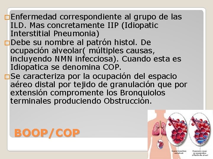 �Enfermedad correspondiente al grupo de las ILD. Mas concretamente IIP (Idiopatic Interstitial Pneumonia) �Debe
